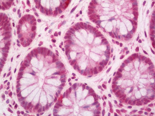 Human Colon: Formalin-Fixed, Paraffin-Embedded (FFPE)