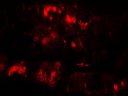 Immunofluorescence of SLC29A3 in rat colon muscle tissue with SLC29A3 antibody at 20 ug/mL.