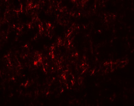 Immunofluorescence of SLC29A4 in human brain tissue with SLC29A4 antibody at 20 ug/mL.