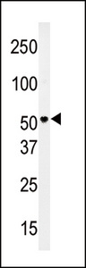 Western blot of anti-PMAT(Slc29a4) Antibody in HepG2 cell line lysates (35 ug/lane). PMAT(arrow) was detected using the purified antibody.