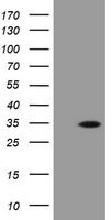 HEK293T cells were transfected with the pCMV6-ENTRY control (Left lane) or pCMV6-ENTRY PROSC (Right lane) cDNA for 48 hrs and lysed. Equivalent amounts of cell lysates (5 ug per lane) were separated by SDS-PAGE and immunoblotted with anti-PROSC.