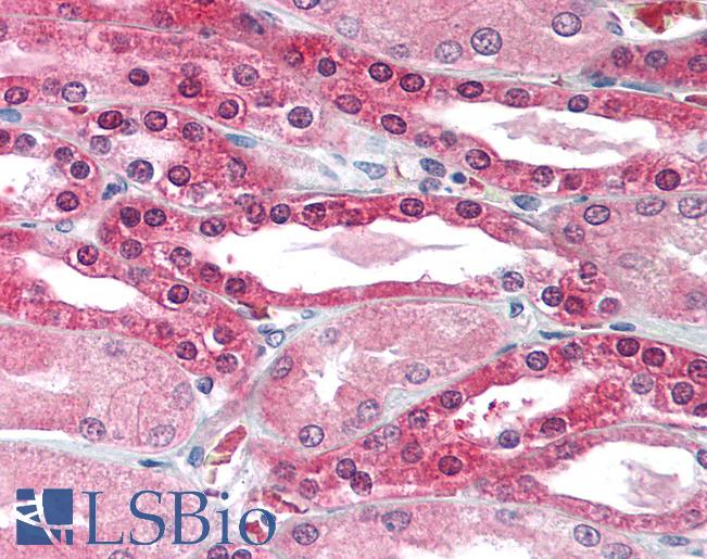 Anti-SLC2A10 antibody IHC of human kidney. Immunohistochemistry of formalin-fixed, paraffin-embedded tissue after heat-induced antigen retrieval. Antibody LS-B1622 concentration 5 ug/ml.