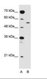A: Marker, B: Jurkat Cell Lysate