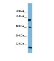 Western blot of Human NCI-H226. SLC2A10 antibody dilution 1.0 ug/ml.