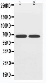 WB of SLC2A12 / GLUT12 antibody. Lane 1: PC-12 Cell Lysate. Lane 2: A549 Cell Lysate.
