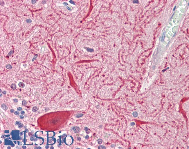 Anti-SLC2A13 / HMIT / GLUT13 antibody IHC staining of human brain, cerebellum. Immunohistochemistry of formalin-fixed, paraffin-embedded tissue after heat-induced antigen retrieval. Antibody LS-B9621 dilution 1:100.