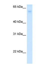 SLC2A2 / GLUT2 antibody LS-C40343 Western blot of Fetal Liver lysate.