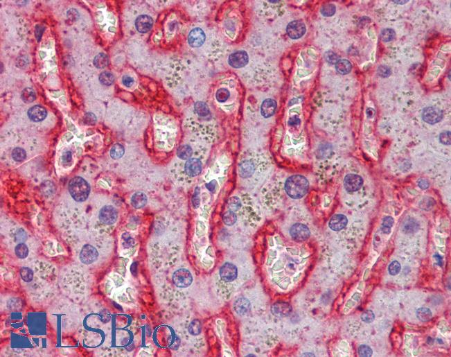 Anti-GLUT2 antibody IHC of human liver. Immunohistochemistry of formalin-fixed, paraffin-embedded tissue after heat-induced antigen retrieval. Antibody LS-B4177 concentration 2.5 ug/ml.