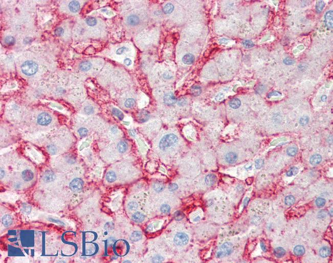 Anti-GLUT2 antibody IHC of human liver. Immunohistochemistry of formalin-fixed, paraffin-embedded tissue after heat-induced antigen retrieval. Antibody LS-B2421 concentration 10 ug/ml.
