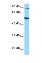 SLC2A3 / GLUT3 antibody LS-C146477 Western blot of COL0205 Cell lysate. Antibody concentration 1 ug/ml.