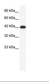 Jurkat Cell Lysate