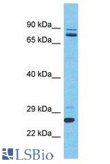 SLC2A4RG / GEF antibody Western Blot of Thymus Tumor. Antibody dilution: 1 ug/ml.