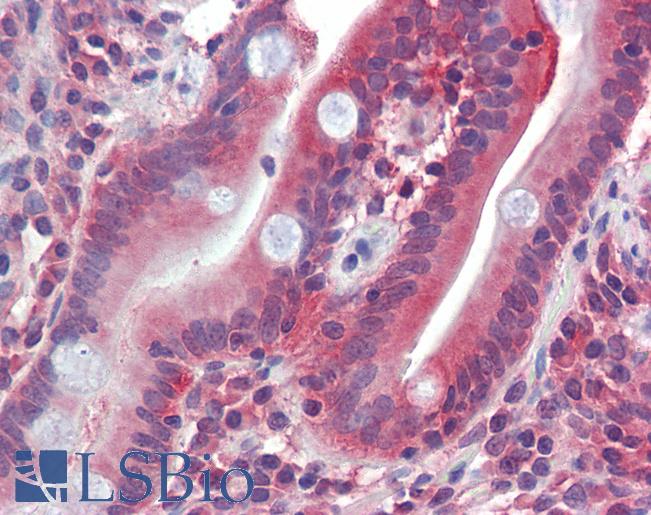 Anti-SLC2A5 / GLUT5 antibody IHC of human small intestine. Immunohistochemistry of formalin-fixed, paraffin-embedded tissue after heat-induced antigen retrieval. Antibody LS-B4178 concentration 2.5 ug/ml.