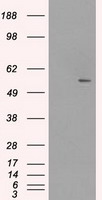 HEK293T cells were transfected with the pCMV6-ENTRY control (Left lane) or pCMV6-ENTRY SLC2A5 (Right lane) cDNA for 48 hrs and lysed. Equivalent amounts of cell lysates (5 ug per lane) were separated by SDS-PAGE and immunoblotted with anti-SLC2A5.