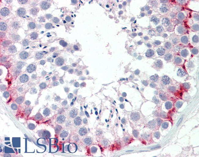 Anti-SLC30A9 / ZNT9 antibody IHC staining of human testis. Immunohistochemistry of formalin-fixed, paraffin-embedded tissue after heat-induced antigen retrieval. Antibody LS-B9652 concentration 10 ug/ml.