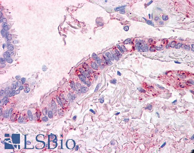 Anti-CTR1 antibody LS-A9259 IHC of human lung, respiratory epithelium. Immunohistochemistry of formalin-fixed, paraffin-embedded tissue after heat-induced antigen retrieval.