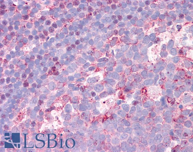 Anti-CTR1 antibody LS-A9259 IHC of human colon, MALT. Immunohistochemistry of formalin-fixed, paraffin-embedded tissue after heat-induced antigen retrieval.