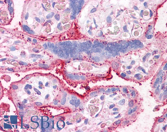 Anti-CTR1 antibody LS-A9258 IHC of human placenta. Immunohistochemistry of formalin-fixed, paraffin-embedded tissue after heat-induced antigen retrieval.
