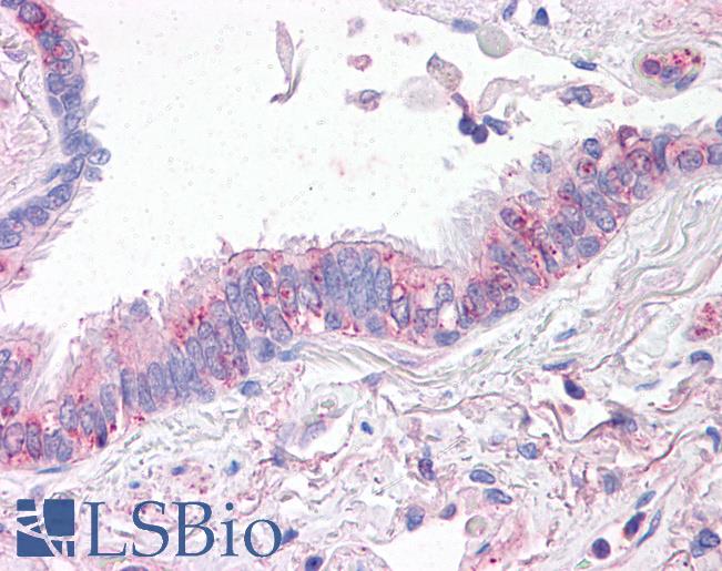Anti-CTR1 antibody LS-A9258 IHC of human lung, respiratory epithelium. Immunohistochemistry of formalin-fixed, paraffin-embedded tissue after heat-induced antigen retrieval.