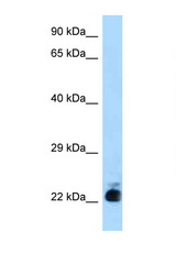 SLC31A1 / CTR1 antibody LS-C146094 Western blot of Mouse Liver lysate. Antibody concentration 1 ug/ml.