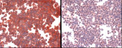 The photo on the left is antibody staining of hCTR1 overexpressing cell line. The photo on the right is antibody plus peptide competition staining.