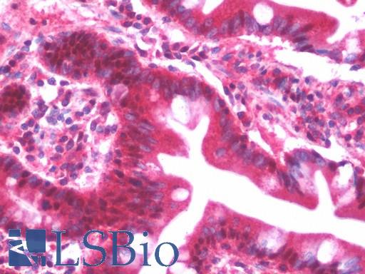Anti-SLC31A1 / CTR1 antibody IHC staining of human small intestine. Immunohistochemistry of formalin-fixed, paraffin-embedded tissue after heat-induced antigen retrieval. Antibody LS-B10411 dilution 1:100.
