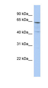 SLC32A1 antibody LS-C110858 Western blot of PANC1 cell lysate.