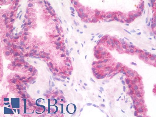 Anti-SLC33A1 antibody IHC staining of human prostate. Immunohistochemistry of formalin-fixed, paraffin-embedded tissue after heat-induced antigen retrieval.