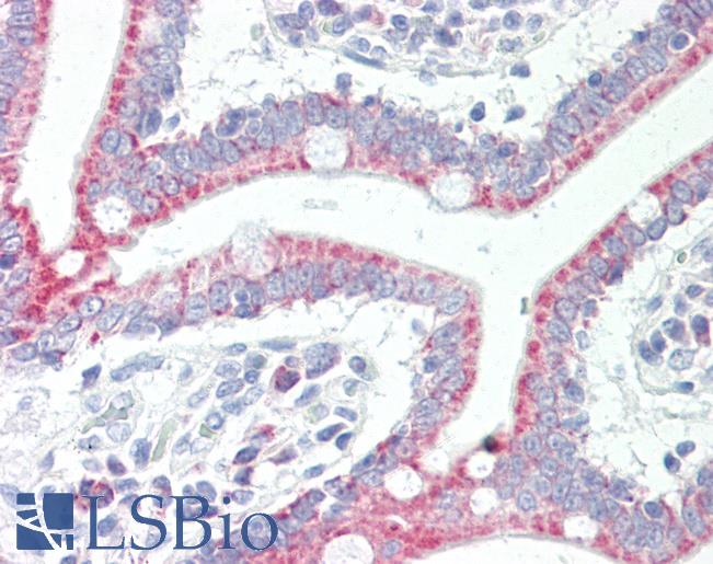 Human Small Intestine: Formalin-Fixed, Paraffin-Embedded (FFPE)