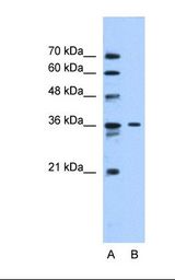 Lane A: Marker. Lane B: HepG2 cell lysate. Antibody concentration: 0.5 ug/ml. Gel concentration: 12%.