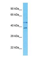 Western blot of SLC35B2 Antibody with human 786-0 Whole Cell lysate.
