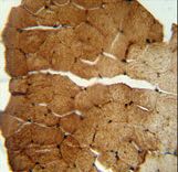 S35B2 antibody immunohistochemistry of formalin-fixed and paraffin-embedded human skeletal muscle followed by peroxidase-conjugated secondary antibody and DAB staining.