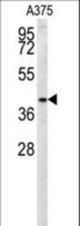 S35B2 Antibody western blot of A375 cell line lysates (35 ug/lane). The S35B2 antibody detected the S35B2 protein (arrow).