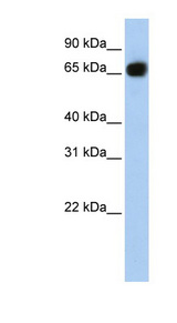 SLC37A1 antibody LS-C102070 Western blot of Fetal Brain lysate.