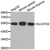 Western blot analysis of extracts of various cell lines, using SLC37A2 antibody.