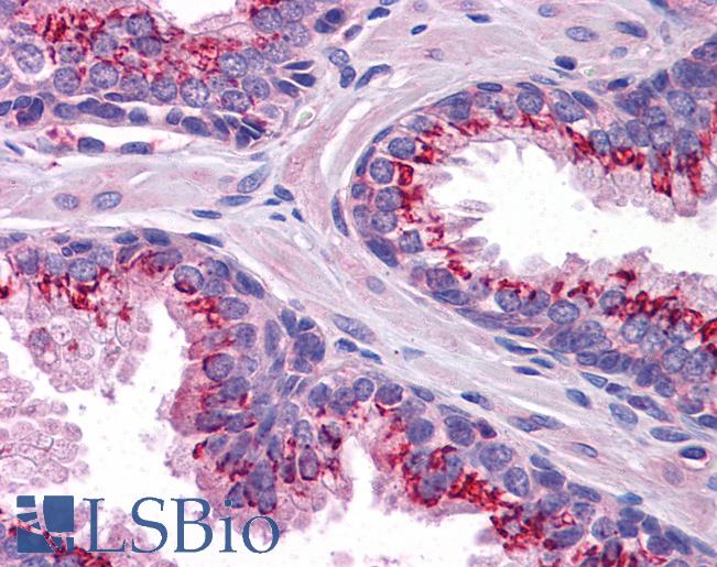 Anti-SLC37A2 antibody IHC of human prostate. Immunohistochemistry of formalin-fixed, paraffin-embedded tissue after heat-induced antigen retrieval. Antibody LS-B5080 concentration 5 ug/ml.
