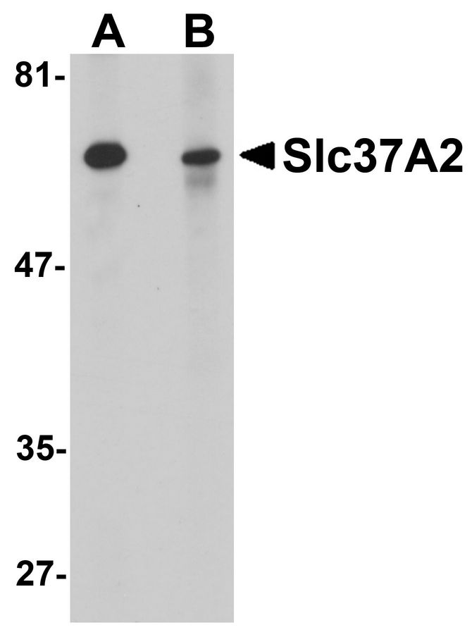 Western blot analysis of Slc37A2 in mouse spleen tissue lysate with Slc37A2 antibody at 1 ug/ml in the (A) absence and (B) presence of blocking peptide.