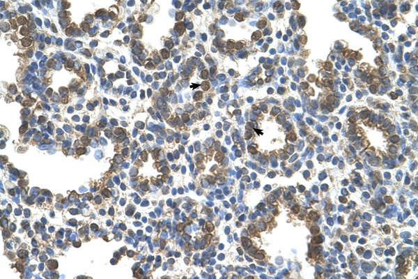SLC37A3 antibody LS-C40445 IHC of formalin-fixed, paraffin-embedded human Lung. Positive label: Alveolar cells indicated with arrows. Antibody concentration 4-8 ug/ml. Magnification 400X.