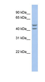 SLC37A4 antibody LS-C110822 Western blot of OVCAR-3 cell lysate.
