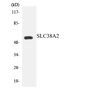Western blot of the lysates from HeLa cells using SLC38A2 antibody.