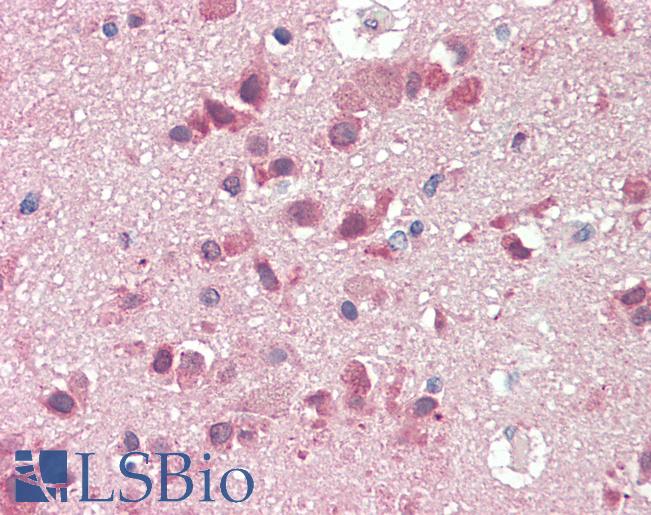 Anti-SLC38A2 / SNAT2 antibody IHC staining of human brain, cortex. Immunohistochemistry of formalin-fixed, paraffin-embedded tissue after heat-induced antigen retrieval. Antibody LS-B9654 concentration 5 ug/ml.