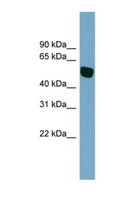 SLC38A5 antibody LS-C110856 Western blot of THP-1 cell lysate.