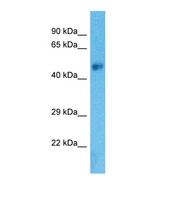Western blot of Human Fetal Brain. SLC38A8 antibody dilution 1.0 ug/ml.