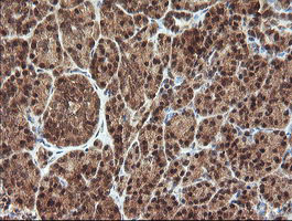 IHC of paraffin-embedded Human pancreas tissue using anti-PROSC mouse monoclonal antibody.