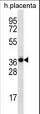 SLC38A8 Antibody western blot of human placenta tissue lysates (35 ug/lane). The SLC38A8 antibody detected the SLC38A8 protein (arrow).