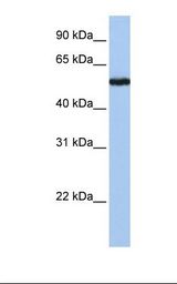 Jurkat cell lysate. Antibody concentration: 1.0 ug/ml. Gel concentration: 12%.