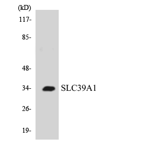 Western blot of the lysates from COLO205 cells using SLC39A1 antibody.