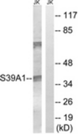 Western blot of extracts from Jurkat cells, using SLC39A1 Antibody. The lane on the right is treated with the synthesized peptide.