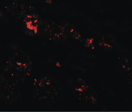 Immunofluorescence of ZIP1 in human kidney tissue with ZIP1 antibody at 20 ug/ml.