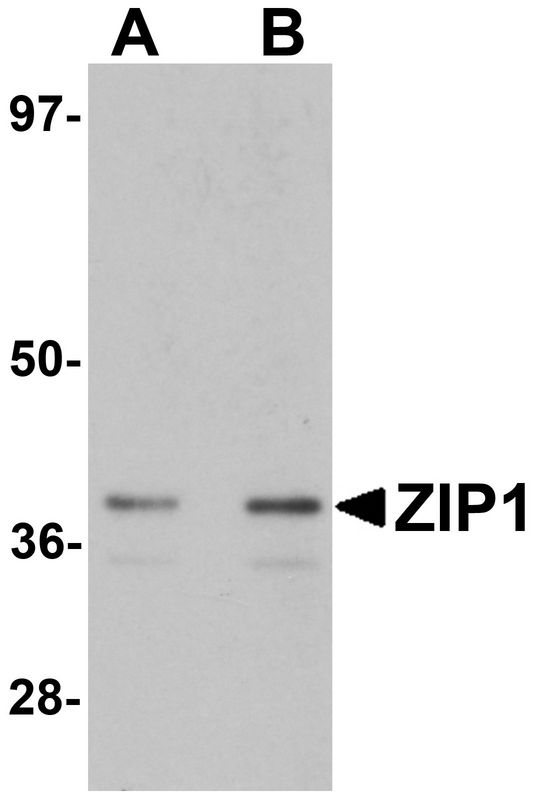 Western blot analysis of ZIP1 in mouse kidney tissue lysate with ZIP1 antibody at (A) 1 and (B) 2 ug/ml.